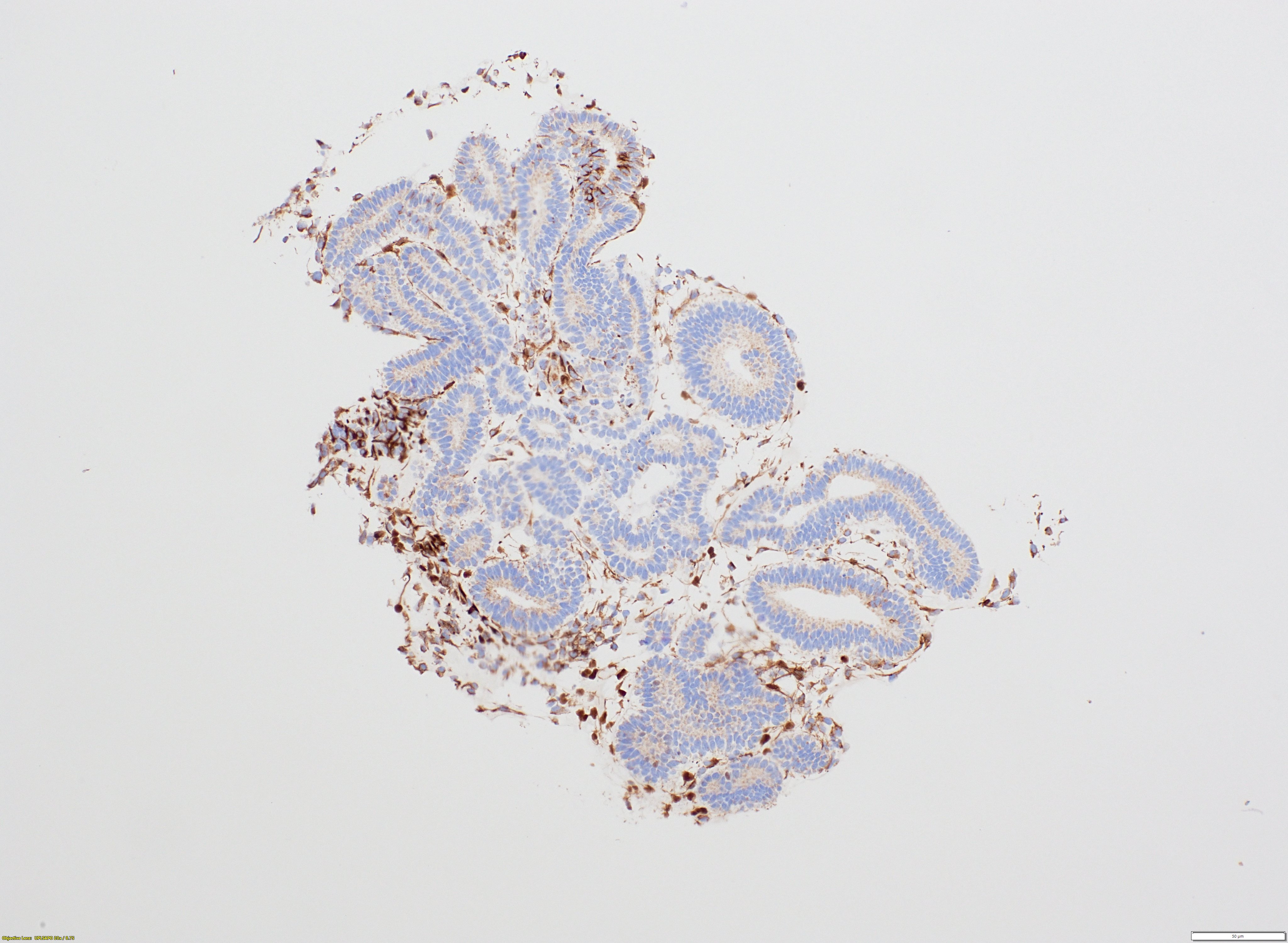 WT1 IHC staining in kidney organoids