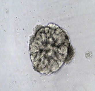 Human kidney organoid cultured with 3DCelMatrix ECM solution