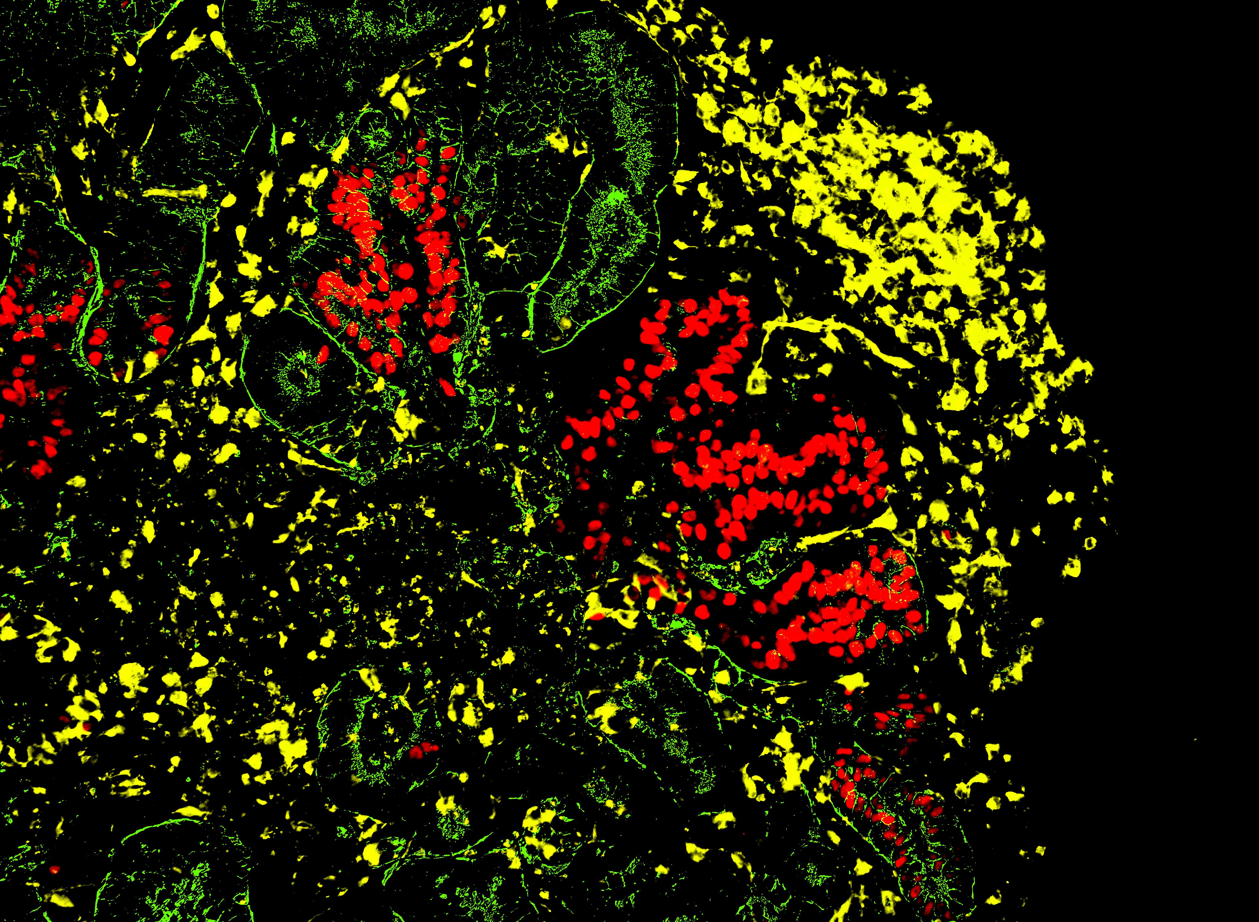 Immunofluorescence image of kidney organoid renal lineage markers WT1, GATA3, and LTL